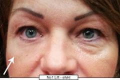 di ANGELO cosmetics Forradalmi szemkörnyékápoló krém azonnali hatással No.1 Lift (Eye Cream) 15 ml