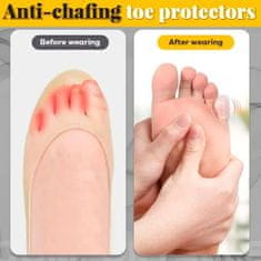 Lábujjvédő szett (10db/csomag) biztos lábvédelem, ujjvédő cipőn belülre, rugalmas szilikon védő | TOEGUARD