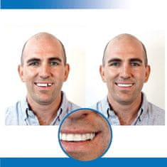 BigBuy Instant smile - fogsor javító készlet vészhelyzet esetére - ideiglenes fogpótlás készítő (BBM)