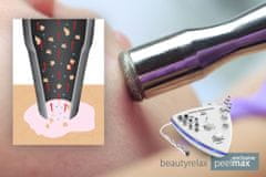 BeautyRelax Gyémánt mikrodermabráziós bőrcsiszoló készülék Peelmax Exclusive