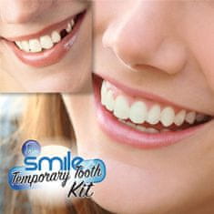 BigBuy Instant smile - fogsor javító készlet vészhelyzet esetére - ideiglenes fogpótlás készítő (BBM)